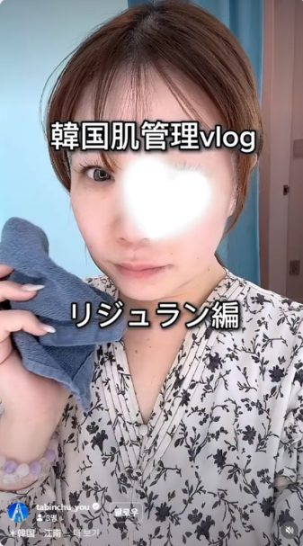 일본 현지 체험단 리쥬란 시술 인스타그램 후기 포트폴리오